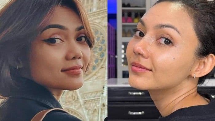 Rina Nose Pamer Transformasi Hidung Usai Operasi Plastik, Pangling di Mata Netizen
