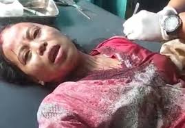 Tragis, Kepala Dusun di Jember Aniaya Perempuan dengan Senjata Tajam