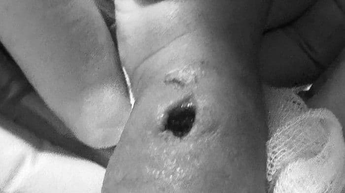 Tangan Bayi Diduga Terluka Saat Perawatan, RS di Makassar Beri Klarifikasi